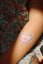 Leukoplasty pink